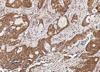 Immunohistochemistry-Paraffin: RUVBL1 Antibody (01) [NBP3-06522]