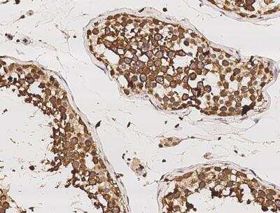 Immunohistochemistry-Paraffin: RUVBL1 Antibody (01) [NBP3-06522]