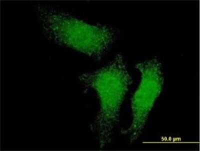 Immunocytochemistry/ Immunofluorescence: RUVBL1 Antibody (3G4-1F8) [H00008607-M01]