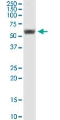 Western Blot: RUVBL1 Antibody (3G4-1F8) [H00008607-M01]