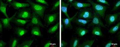 Immunocytochemistry/ Immunofluorescence: RUVBL1 Antibody [NBP2-20245]