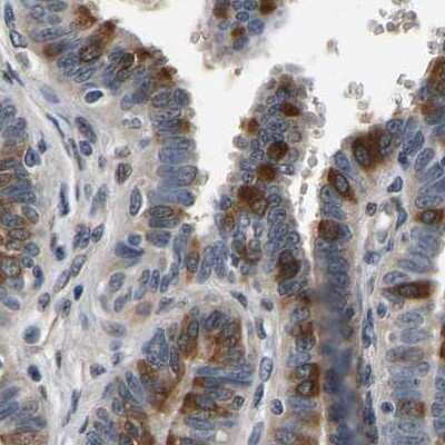 Immunohistochemistry-Paraffin: RUVBL1 Antibody [NBP1-84913]