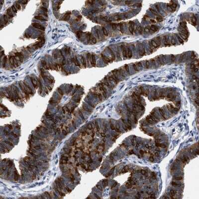 Immunohistochemistry-Paraffin: RUVBL1 Antibody [NBP1-84914]