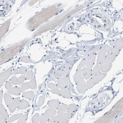 Immunohistochemistry-Paraffin: RUVBL1 Antibody [NBP1-84914]