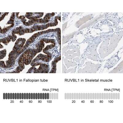 Immunohistochemistry-Paraffin: RUVBL1 Antibody [NBP1-84914]