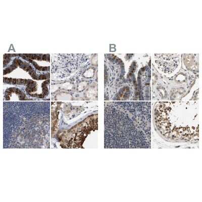Immunohistochemistry-Paraffin: RUVBL1 Antibody [NBP1-84914]