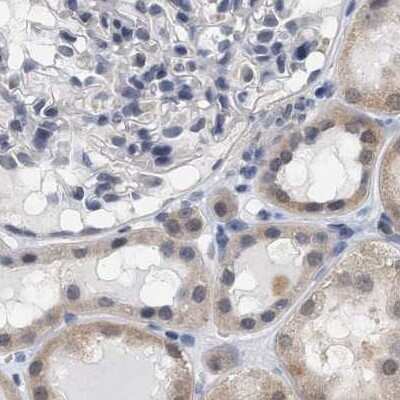 Immunohistochemistry-Paraffin: RUVBL1 Antibody [NBP1-84914]