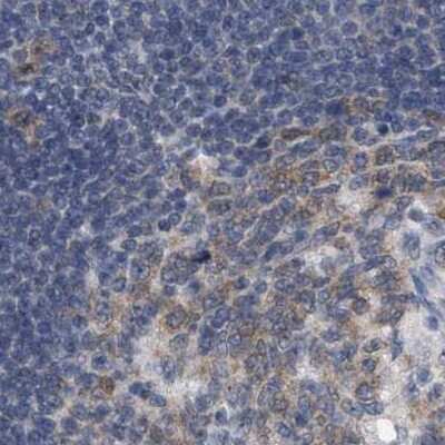 Immunohistochemistry-Paraffin: RUVBL1 Antibody [NBP1-84914]