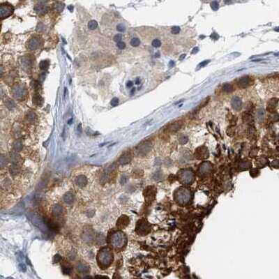 Immunohistochemistry-Paraffin: RUVBL1 Antibody [NBP1-84914]