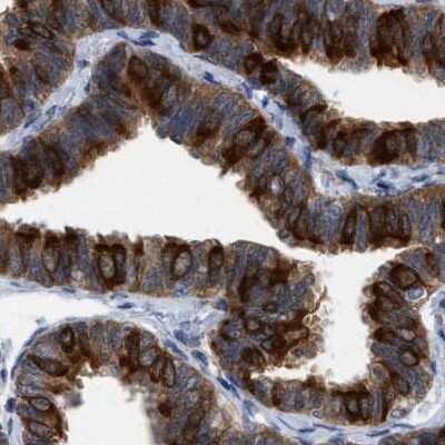 Immunohistochemistry-Paraffin: RUVBL1 Antibody [NBP1-84914]
