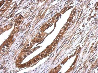 Immunohistochemistry-Paraffin: RUVBL1 Antibody [NBP2-20245]