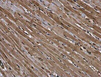 Immunohistochemistry-Paraffin: RUVBL1 Antibody [NBP2-20245]