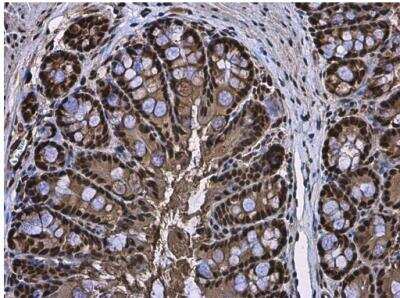 Immunohistochemistry-Paraffin: RUVBL1 Antibody [NBP2-20245]
