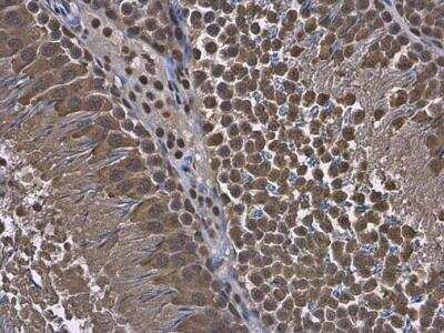 Immunohistochemistry-Paraffin: RUVBL1 Antibody [NBP2-20245]