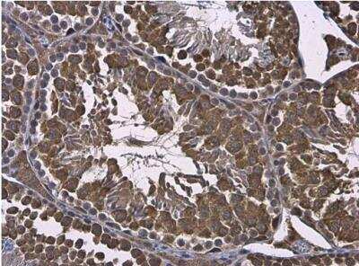 Immunohistochemistry-Paraffin: RUVBL1 Antibody [NBP2-20245]