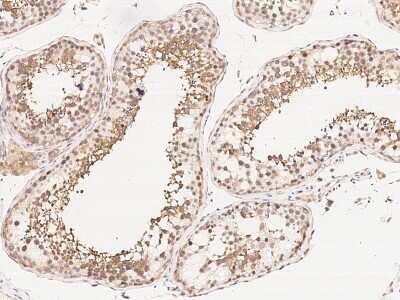 Immunohistochemistry-Paraffin: RUVBL1 Antibody [NBP2-99030]
