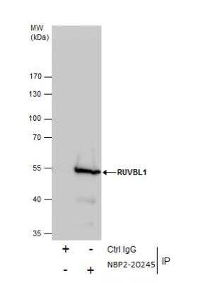 Immunoprecipitation: RUVBL1 Antibody [NBP2-20245]