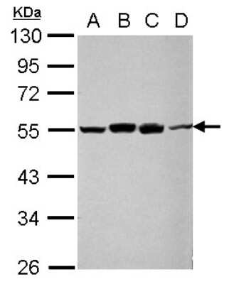 Western Blot: RUVBL1 Antibody [NBP2-20244]