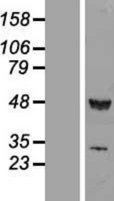 Western Blot: RUVBL1 Overexpression Lysate [NBL1-15631]