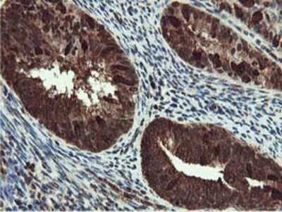 Immunohistochemistry-Paraffin: RUVBL2 Antibody (OTI1A6) [NBP2-01764]
