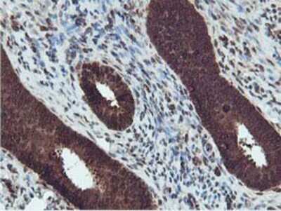Immunohistochemistry-Paraffin: RUVBL2 Antibody (OTI1A6) [NBP2-01764]