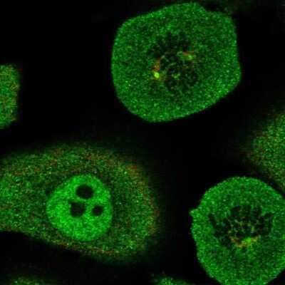 Immunocytochemistry/ Immunofluorescence: RUVBL2 Antibody [NBP2-57593]