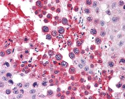Immunohistochemistry-Paraffin: RUVBL2 Antibody [NBP1-33373]