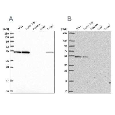 Western Blot: RUVBL2 Antibody [NBP2-55231]