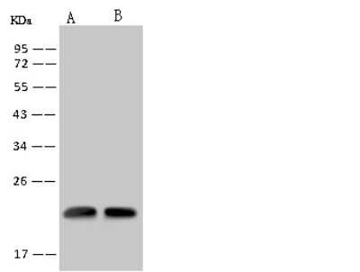 Western Blot: RWDD4A Antibody [NBP2-97777]