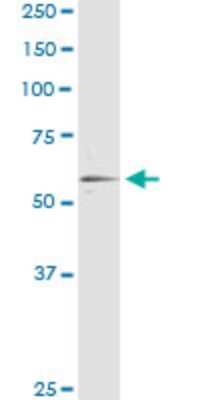 Immunoprecipitation: RXR alpha/NR2B1 Antibody (4B5) [H00006256-M03]
