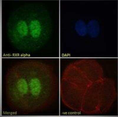 Immunocytochemistry/ Immunofluorescence: RXR alpha/NR2B1 Antibody [NB100-1466]