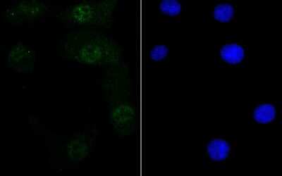 Immunocytochemistry/ Immunofluorescence: RXR alpha/NR2B1 Antibody (JG99-38) [NBP2-75653]