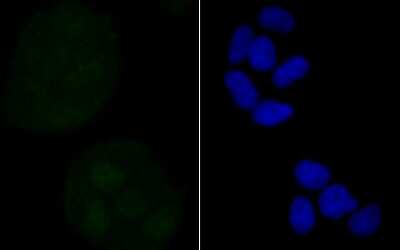 Immunocytochemistry/ Immunofluorescence: RXR alpha/NR2B1 Antibody (JG99-38) [NBP2-75653]
