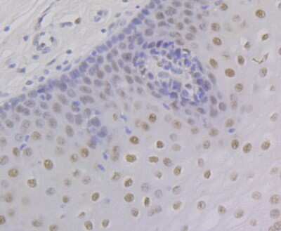 Immunohistochemistry-Paraffin: RXR alpha/NR2B1 Antibody (JG99-38) [NBP2-75653]
