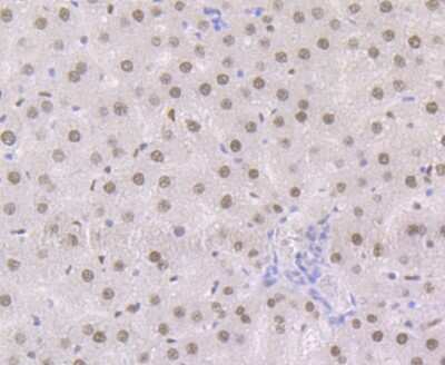 Immunohistochemistry-Paraffin: RXR alpha/NR2B1 Antibody (JG99-38) [NBP2-75653]