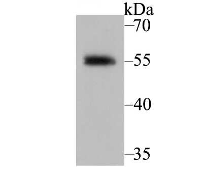Western Blot: RXR alpha/NR2B1 Antibody (JG99-38) [NBP2-75653]
