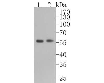 Western Blot: RXR alpha/NR2B1 Antibody (JG99-38) [NBP2-75653]
