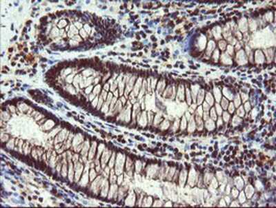 Immunohistochemistry-Paraffin: RYBP/DEDAF Antibody (OTI1B2) [NBP2-02009]