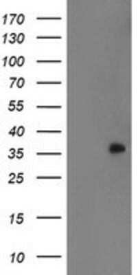 Western Blot: RYBP/DEDAF Antibody (OTI1B2) [NBP2-02009]