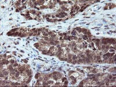 Immunohistochemistry: RYBP/DEDAF Antibody (OTI1B2) - Azide and BSA Free [NBP2-73961]