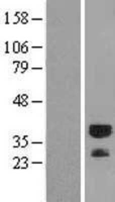 Western Blot: RYBP/DEDAF Overexpression Lysate [NBL1-15645]