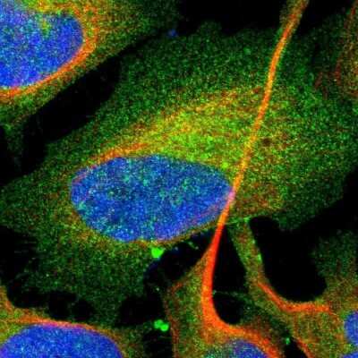 Immunocytochemistry/ Immunofluorescence: Rab13 Antibody [NBP1-85799]