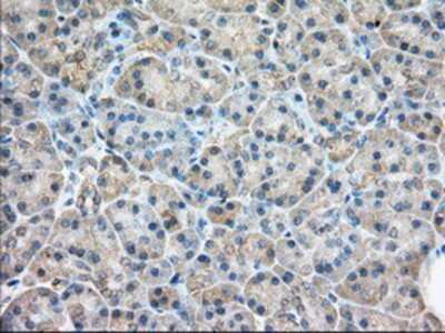 Immunohistochemistry-Paraffin: Rab17 Antibody (OTI5E2) [NBP2-02599]