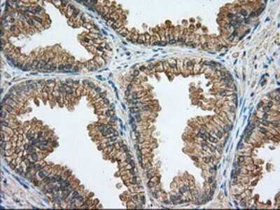 Immunohistochemistry-Paraffin: Rab17 Antibody (OTI5E2) [NBP2-02599]
