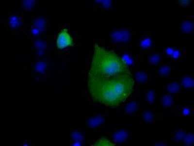 Immunocytochemistry/ Immunofluorescence: Rab17 Antibody (OTI5E2) - Azide and BSA Free [NBP2-73765]