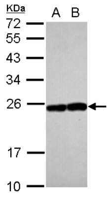 Western Blot: Rab17 Antibody [NBP2-20036]