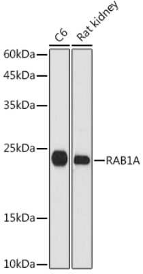 Western Blot: Rab1A AntibodyAzide and BSA Free [NBP2-94057]