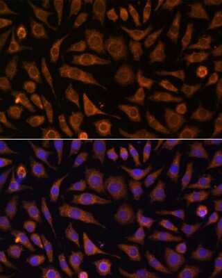 Immunocytochemistry/ Immunofluorescence: Rab1A Antibody - Azide and BSA Free [NBP2-93640]