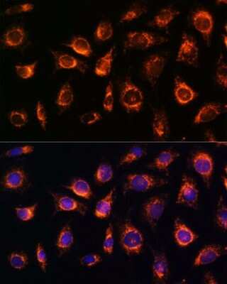 Immunocytochemistry/ Immunofluorescence: Rab1A Antibody - Azide and BSA Free [NBP2-94057]