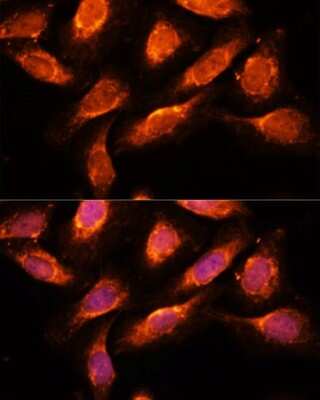 Immunocytochemistry/ Immunofluorescence: Rab1A Antibody - Azide and BSA Free [NBP2-94057]